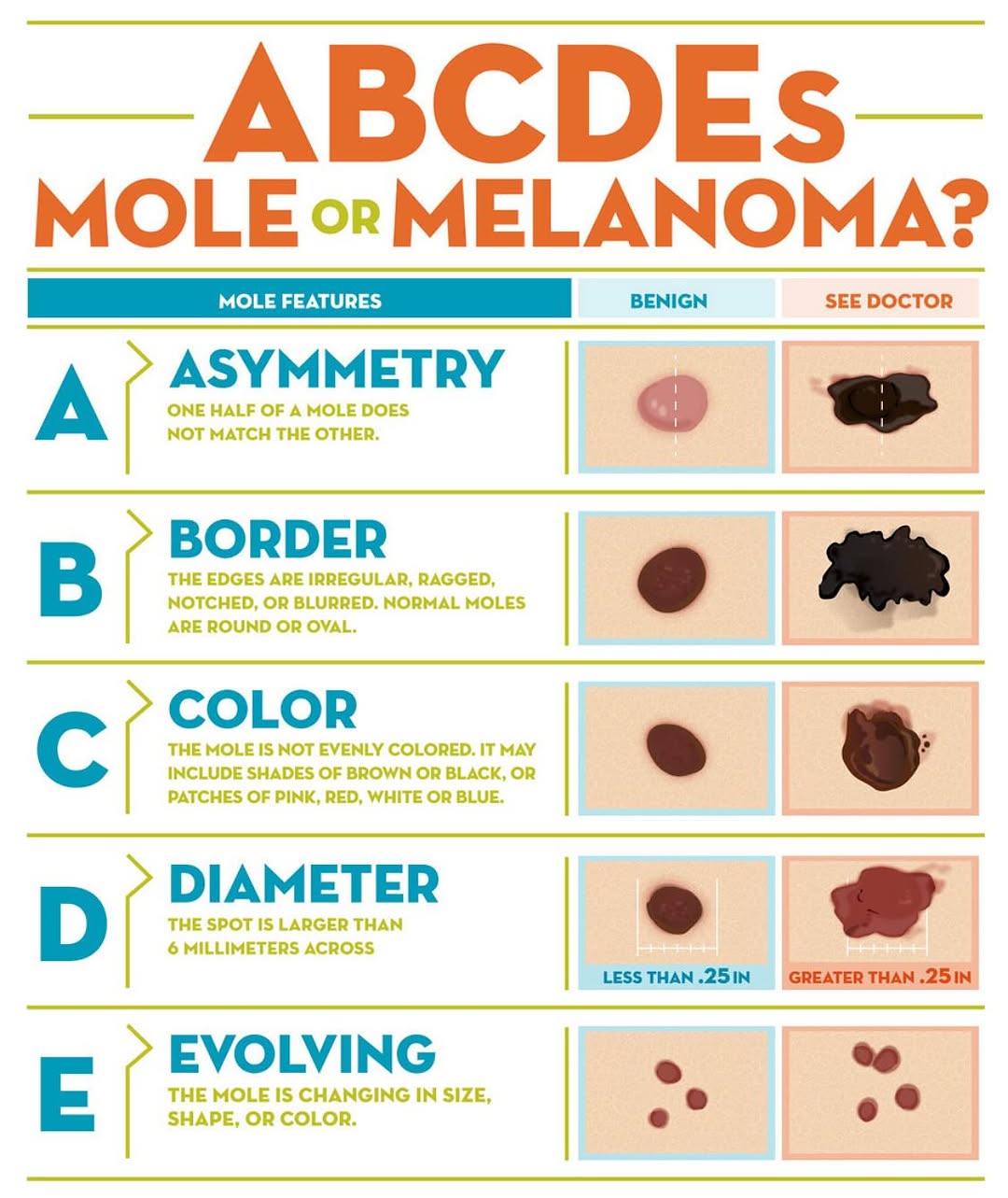 Instagram post by Dr. Ryan Dodde II: MELANOMA MONDAY Today is about more than moles, it’s about lifesaving awareness. These are the warning signs that a mole might be more than …