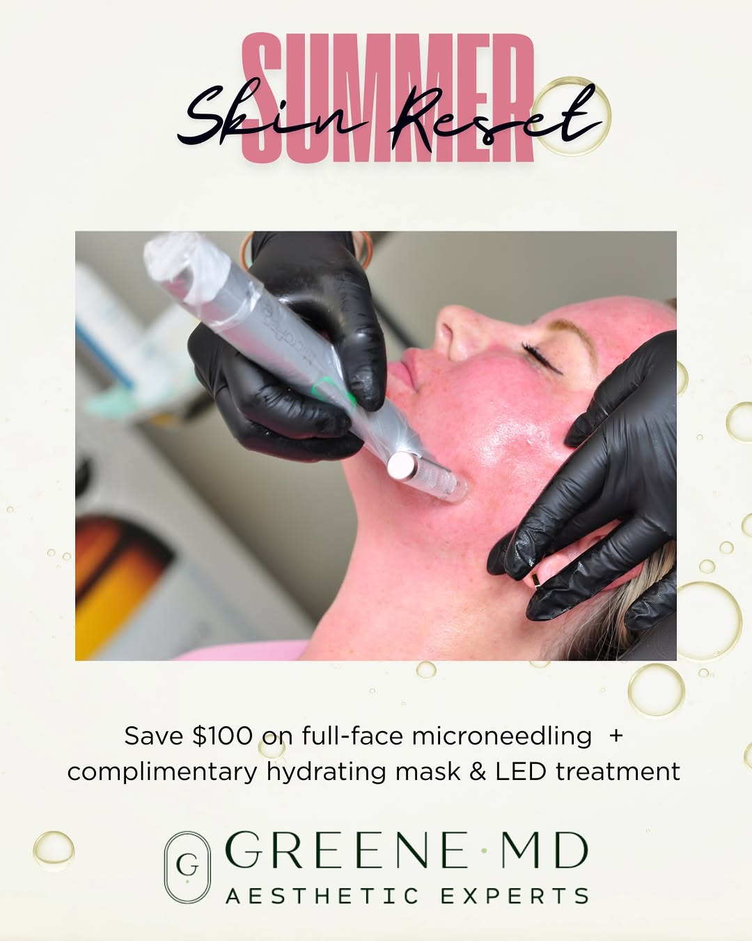 Instagram post by Dr. Ryan Greene: 🫧Refresh your skin this summer and save $100 on any customized microneedling treatment this month. Microneedling stimulates your body’s nat…