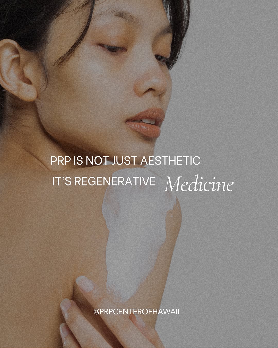 Instagram post by Dr. S. Larry Schlesinger: PRP is not just about appearance. It is a regenerative approach focused on healing, tissue support, and long-term function. When the body he…