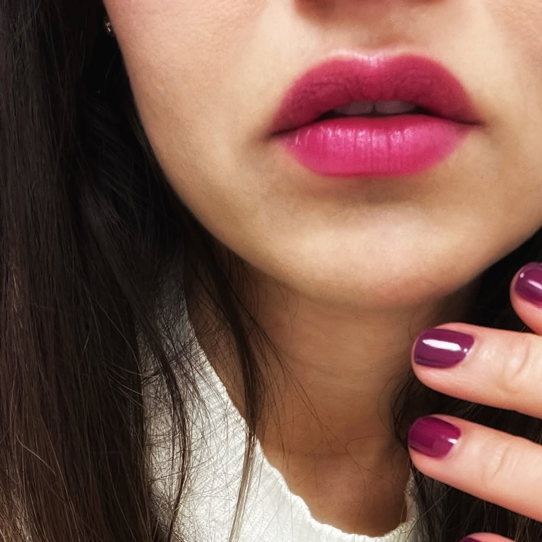 Instagram post by Dr. Saba Ghorab: Let’s talk about LIP AESTHETIC IDEALS 💋 (with a little lip rouge to set the mood 😘) What makes lips BEAUTIFUL? 😍🥰 💋 Size 💋 Shape 💋 Sy…