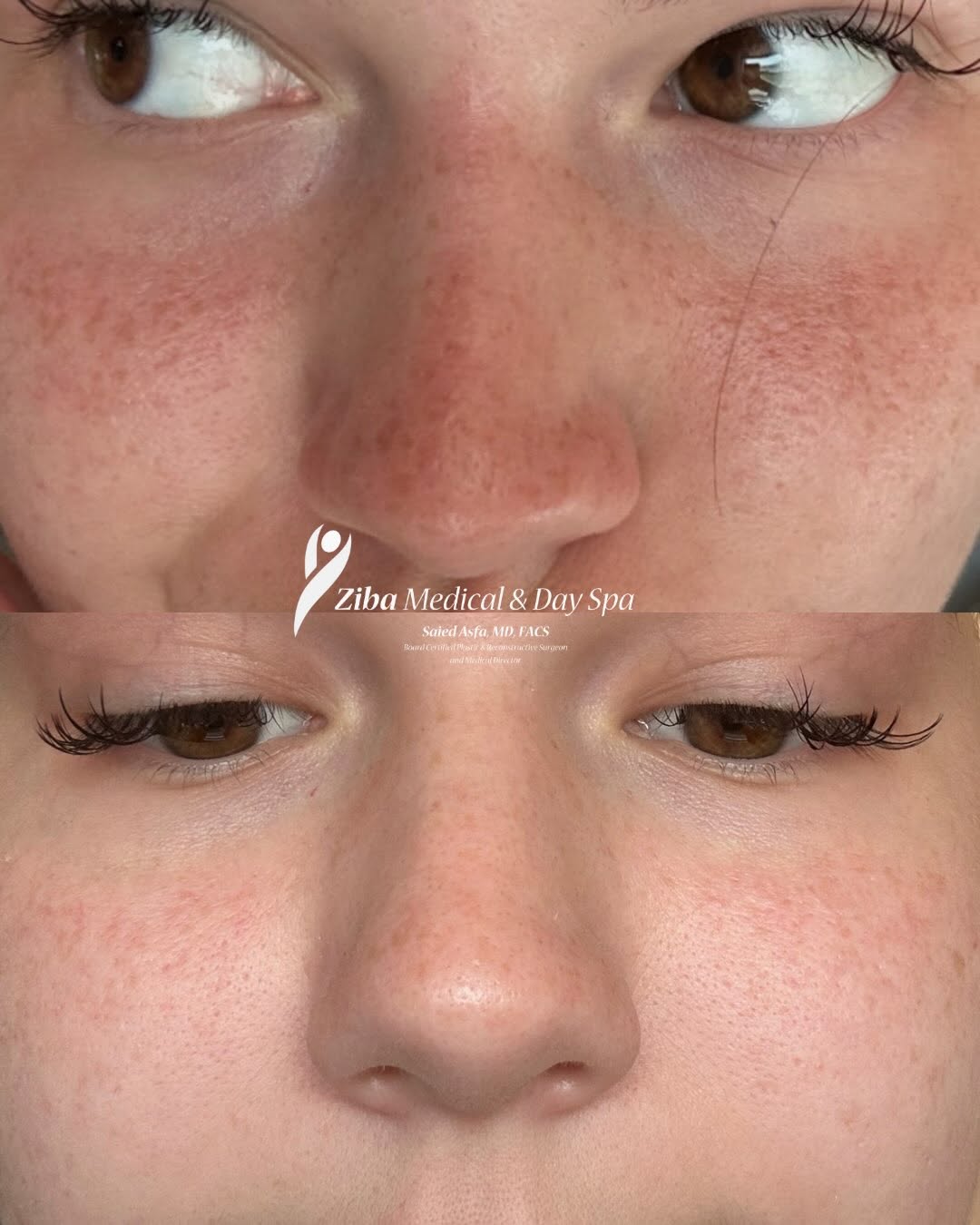Instagram post by Dr. Saied Asfa: The power of a great product!! ✨ Just 3 weeks between these before & after photos, and what a difference! Summer sun can take a toll on skin…