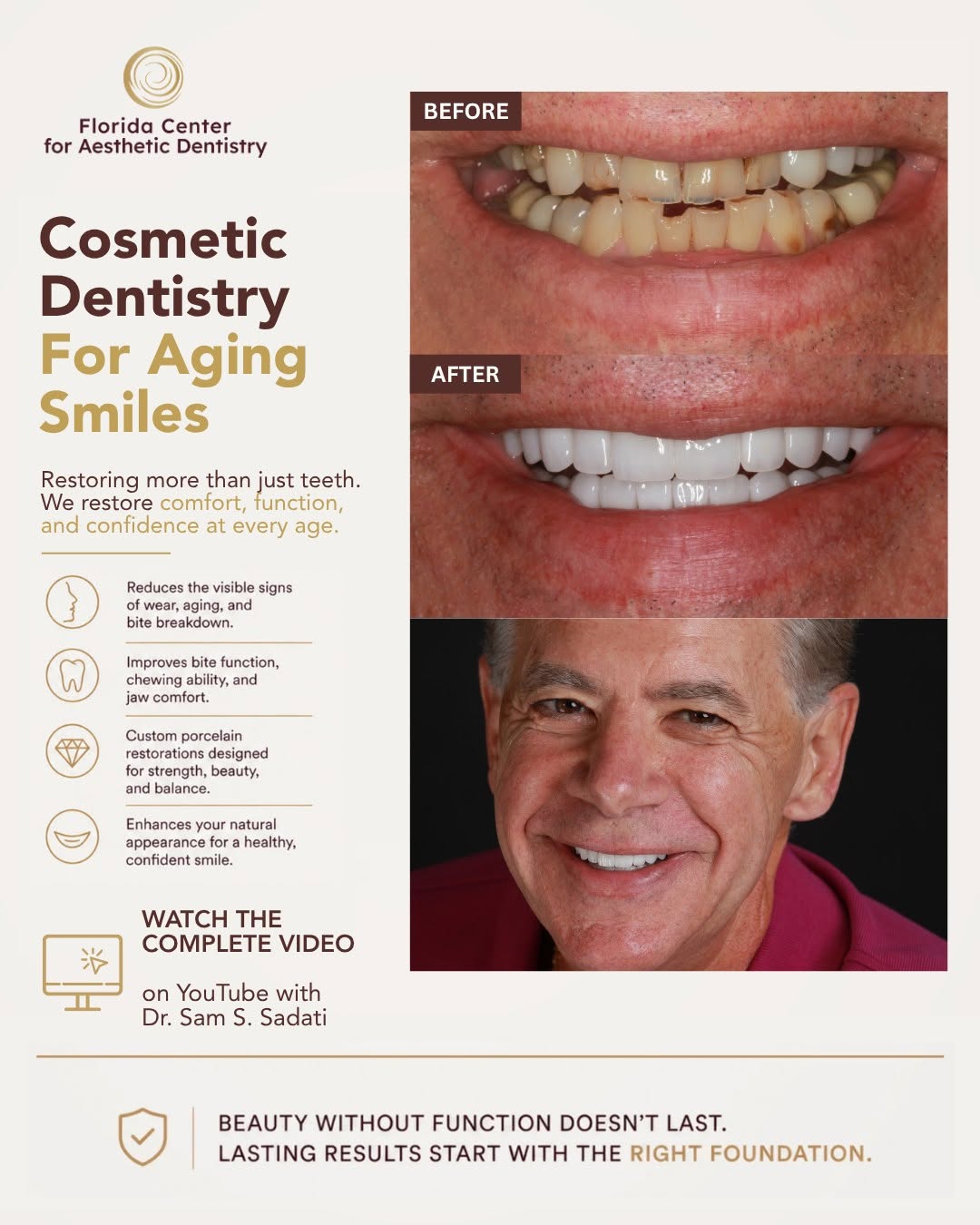 Instagram post by Dr. Sam S. Sadati: A worn smile can make you look older than you feel, but with the right expertise, it can be rebuilt with precision and artistry. At Florida …