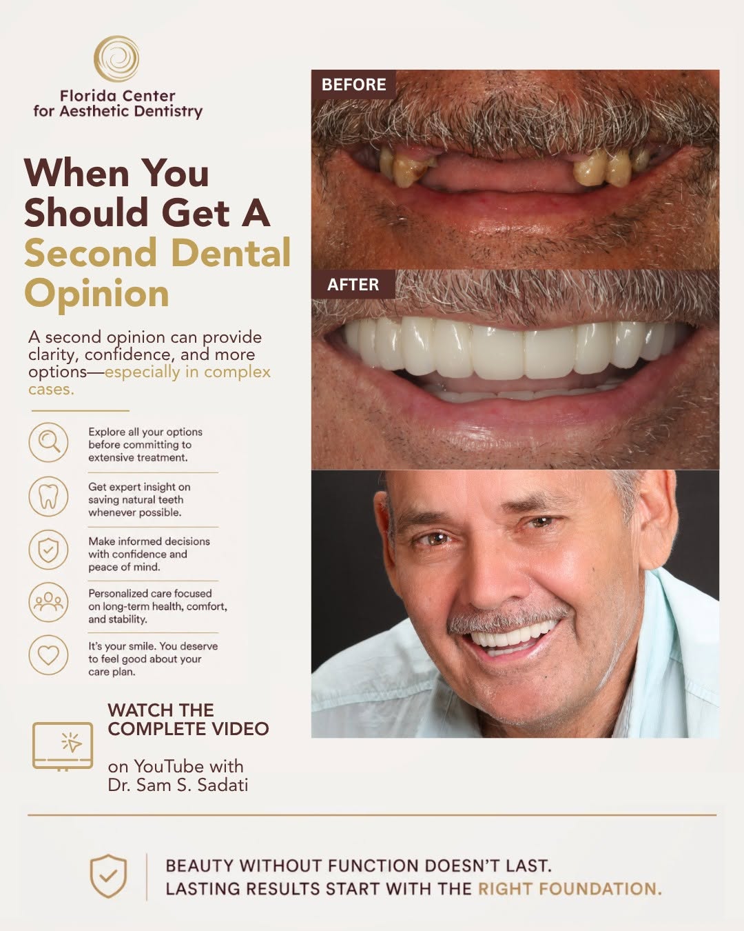 Instagram post by Dr. Sam S. Sadati: This transformation is a powerful example of why complex dental cases deserve a second look. 👀☑️ For this patient, the goal wasn’t simply t…