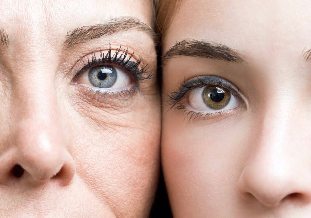 Instagram post by Dr. Sam Speron: The delicate area around the eyes is often one of the first places where aging becomes noticeable. Loose upper-eyelid skin or puffiness bene…