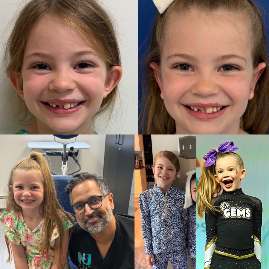 Instagram post by Dr. Samir Undavia: This might be one of the cutest girls ever! And she has one of the biggest smiles ever. It’s infectious!!! Here she is all smiles after her …
