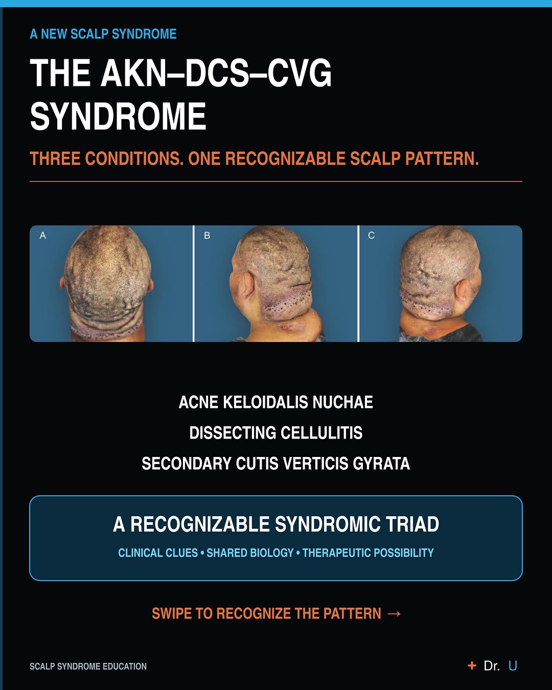 Instagram post by Dr. Sanusi Umar: . .What if the most obvious scalp problem is only part of the picture? Could severe bumps at the back of the head, painful scalp swellings a…