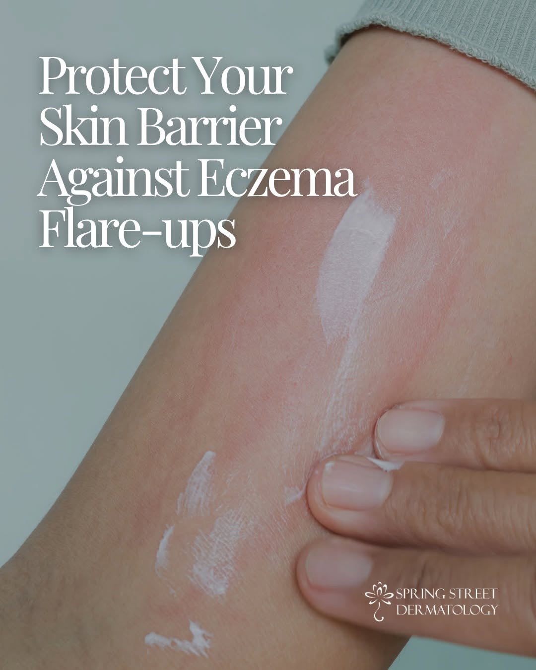 Instagram post by Dr. Sapna Palep: Spring allergies can trigger eczema flare-ups. 🌿 If your skin feels itchy or inflamed, we can help calm, repair, and protect your skin barr…