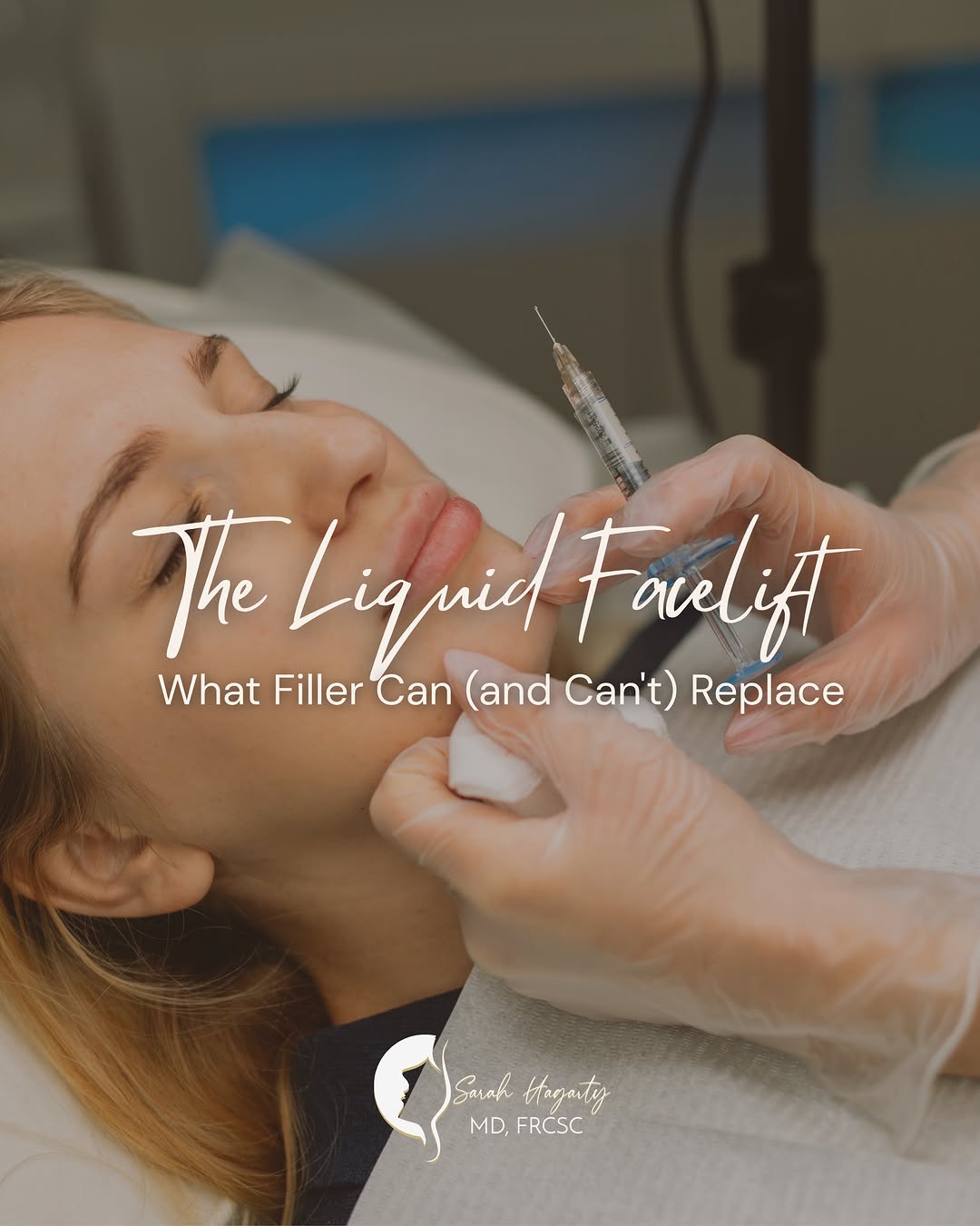 Instagram post by Dr. Sarah E. Hagarty: “Liquid facelift” gets thrown around a lot, so let’s clear up what it actually means. Filler can restore lost volume, soften certain lines, …