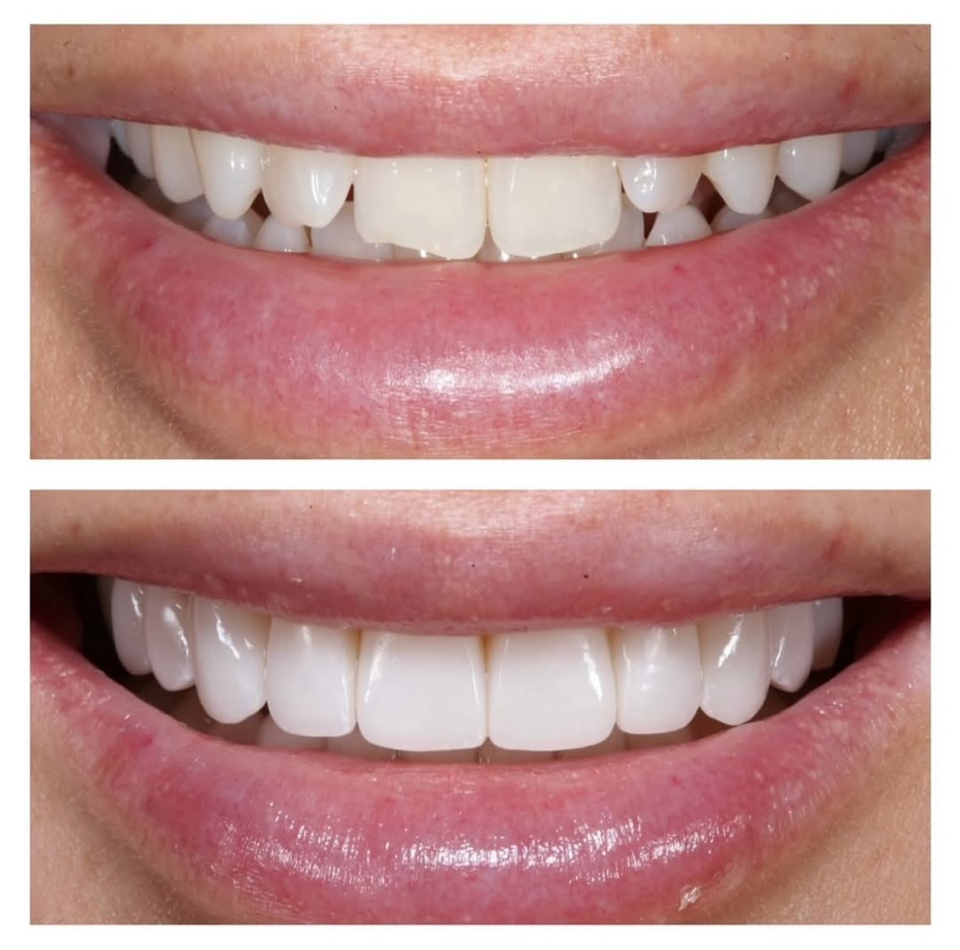 Instagram post by Dr. Sarah F. Winter, D: February is the month of love ❤️ and there’s nothing more lovable than a confident, healthy smile. Show yours some extra care this month… it…