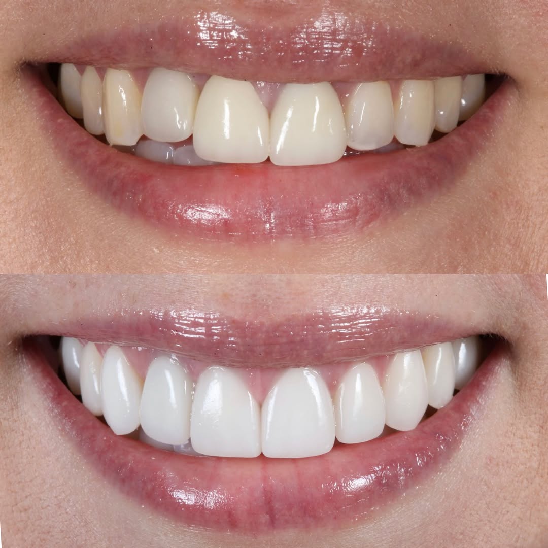 Instagram post by Dr. Sarah F. Winter, D: The art of a perfect smile 🦷✨ Here's how to perfect yours! Use the link in bio 1️⃣Upload a smile selfie 2️⃣share your goals with Dr. Winter…