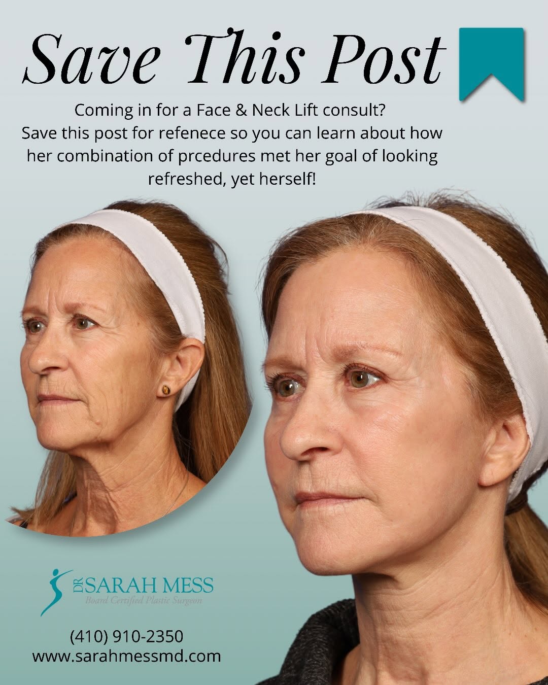 Instagram post by Dr. Sarah Mess: SAVE THIS POST FOR WHEN YOU’RE READY FOR YOUR CONSULT ✨ 🌟The goal isn’t to look like a different person—it’s to look like the best, most re…