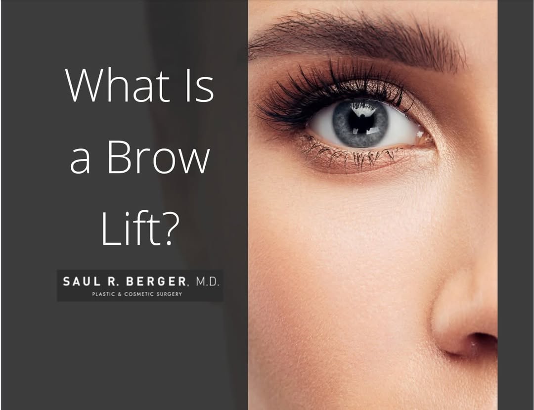 Instagram post by Dr. Saul R. Berger: What Is A Brow Lift? 👨🏼⚕️ In a forehead lift( Brow Lift), the muscles and tissues that cause the furrowing or drooping are removed or alt…