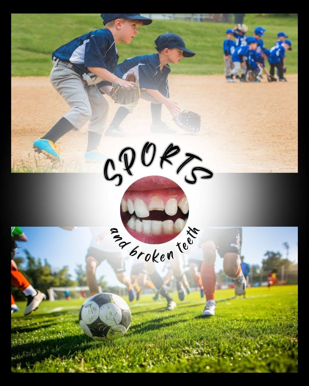 Instagram post by Dr. Scott Greenhalgh, DDS: It doesn't have to be a hockey puck or an intense football tackle that takes your tooth out. You know that grounder that just pops right up …