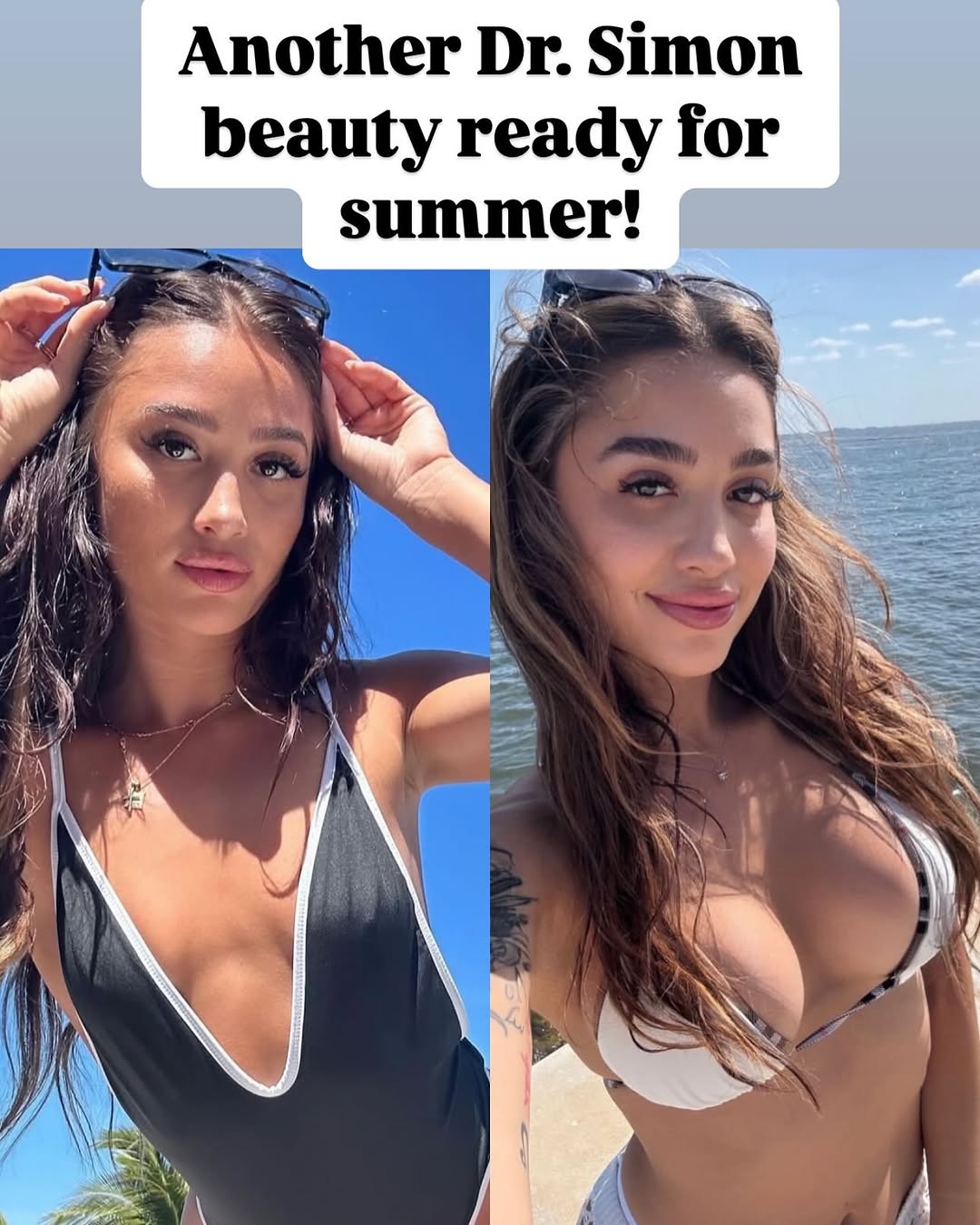 Instagram post by Dr. Sean A. Simon: Get that summer body ready with Dr. Simon! #breastaug #miami #miamiplasticsurgeron #summer #summervibes