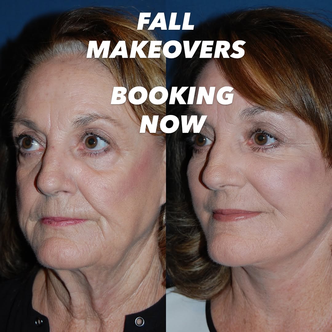 Instagram post by Dr. Sean Freeman: Give us a call to schedule your consultation and book your FALL MAKEOVER! (704) 543-1110 #charlotteplasticsurgeon #charlotteplasticsurgery #…