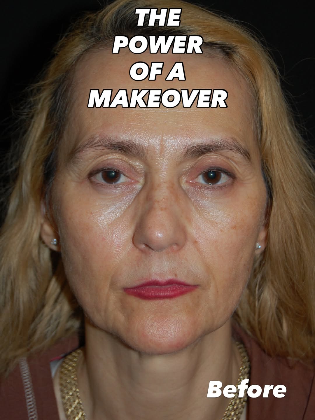 Instagram post by Dr. Sean Freeman: This is one of our latest makeovers and it was life changing for this lovely lady! We are so happy to be part of this journey with her! Hope…