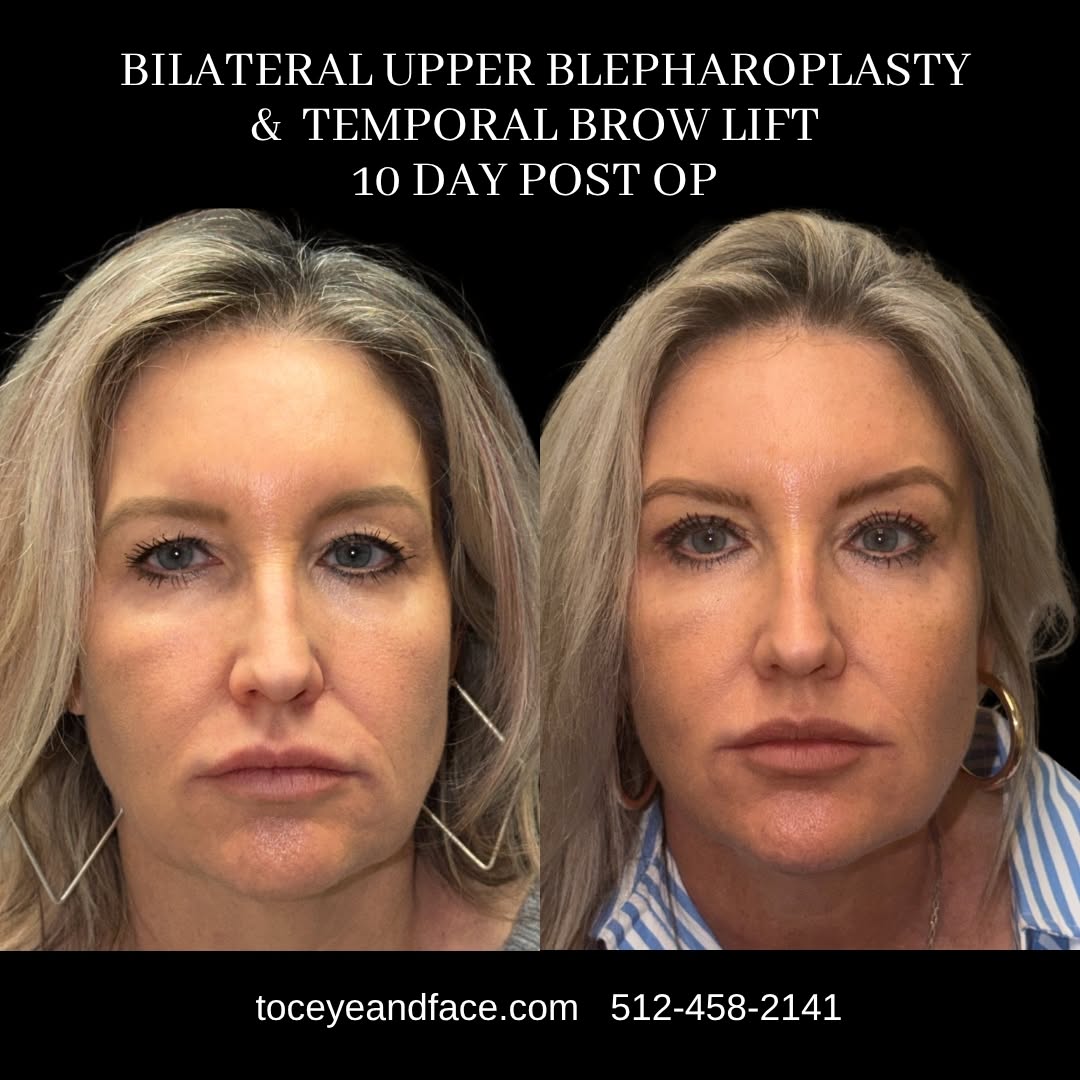 Emphasizing Natural Beauty in Cosmetic Surgery  The goal is to create a harmonious balance, highlighting the patient’s features to boost their confidence while preserving their individuality.  Our won