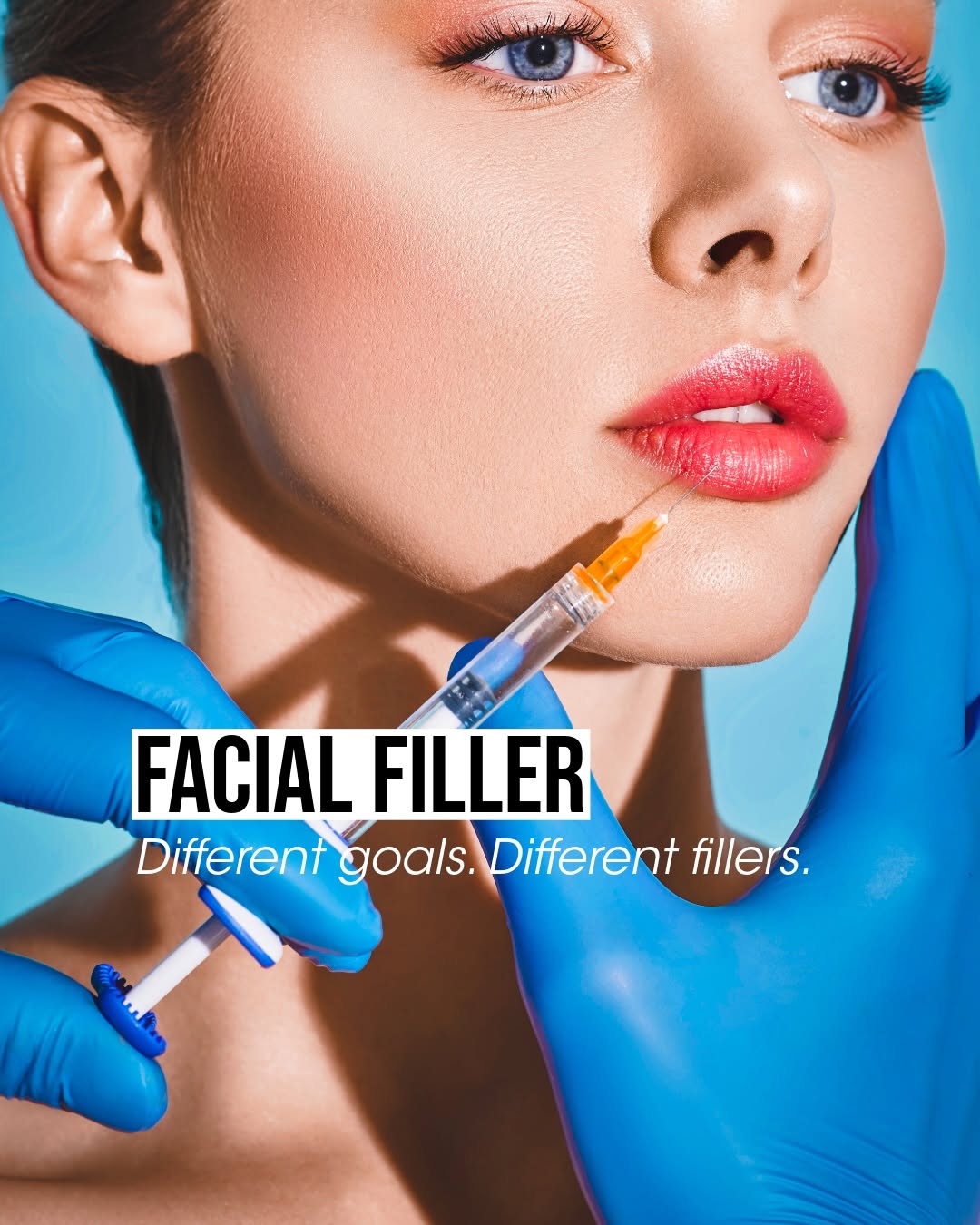 Instagram post by Dr. Sepehr Egrari: Different treatment goals call for different fillers. Different hyaluronic acid fillers are designed to behave differently depending on the …