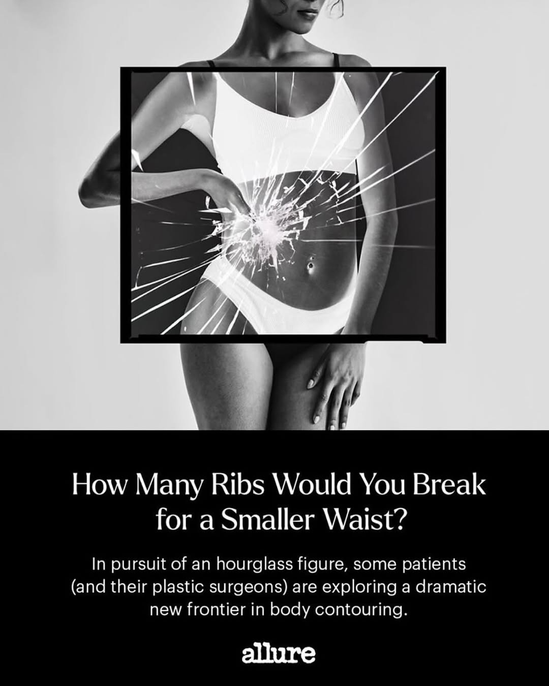 Instagram post by Dr. Sergey Y. Turin: Honored to be featured in Allure discussing one of the most specialized and misunderstood procedures in plastic surgery—rib remodeling. Huge…