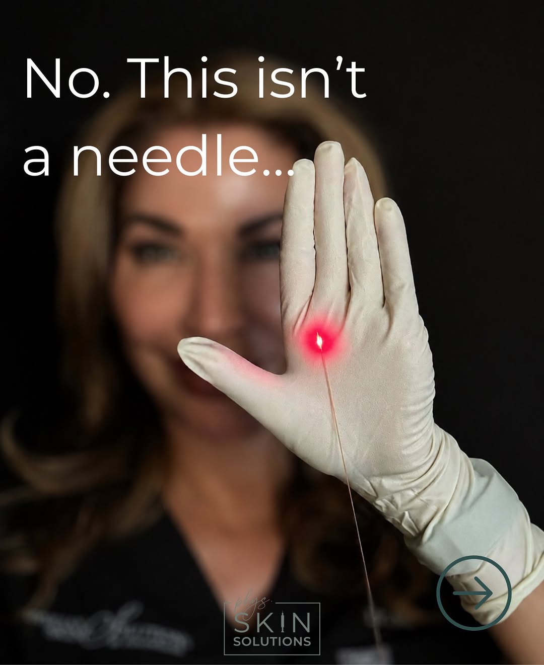 Instagram post by Dr. Shannon Maltais, N: No, it isn’t a needle. It’s the Endolift laser fiber, about the thickness of a strand of hair. This tiny fiber works beneath the skin to sti…