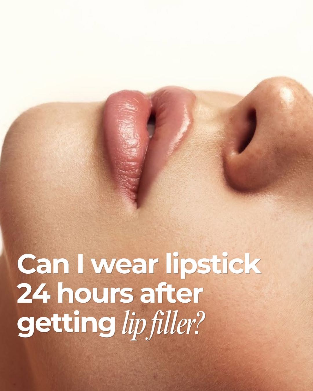 Instagram post by Dr. Shari Topper: When it comes to lip filler, always follow the aftercare protocol recommended by your injector. And makeup? It’s best to wait until your pro…