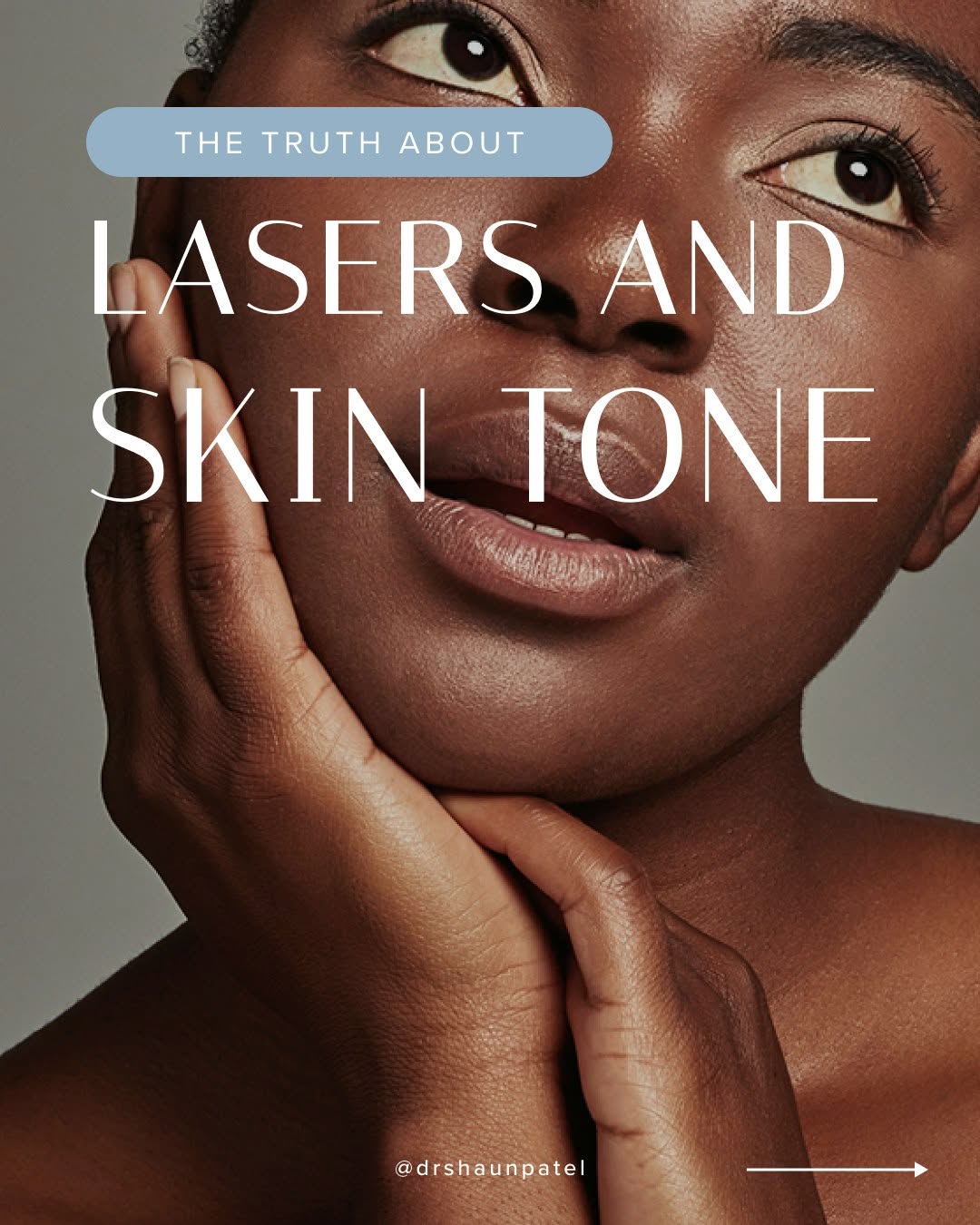 Instagram post by Dr. Shaun Patel: Most patients think laser treatment is one-size-fits-all. It is not, and skin tone is a big part of why. Older lasers relied on heat, which …