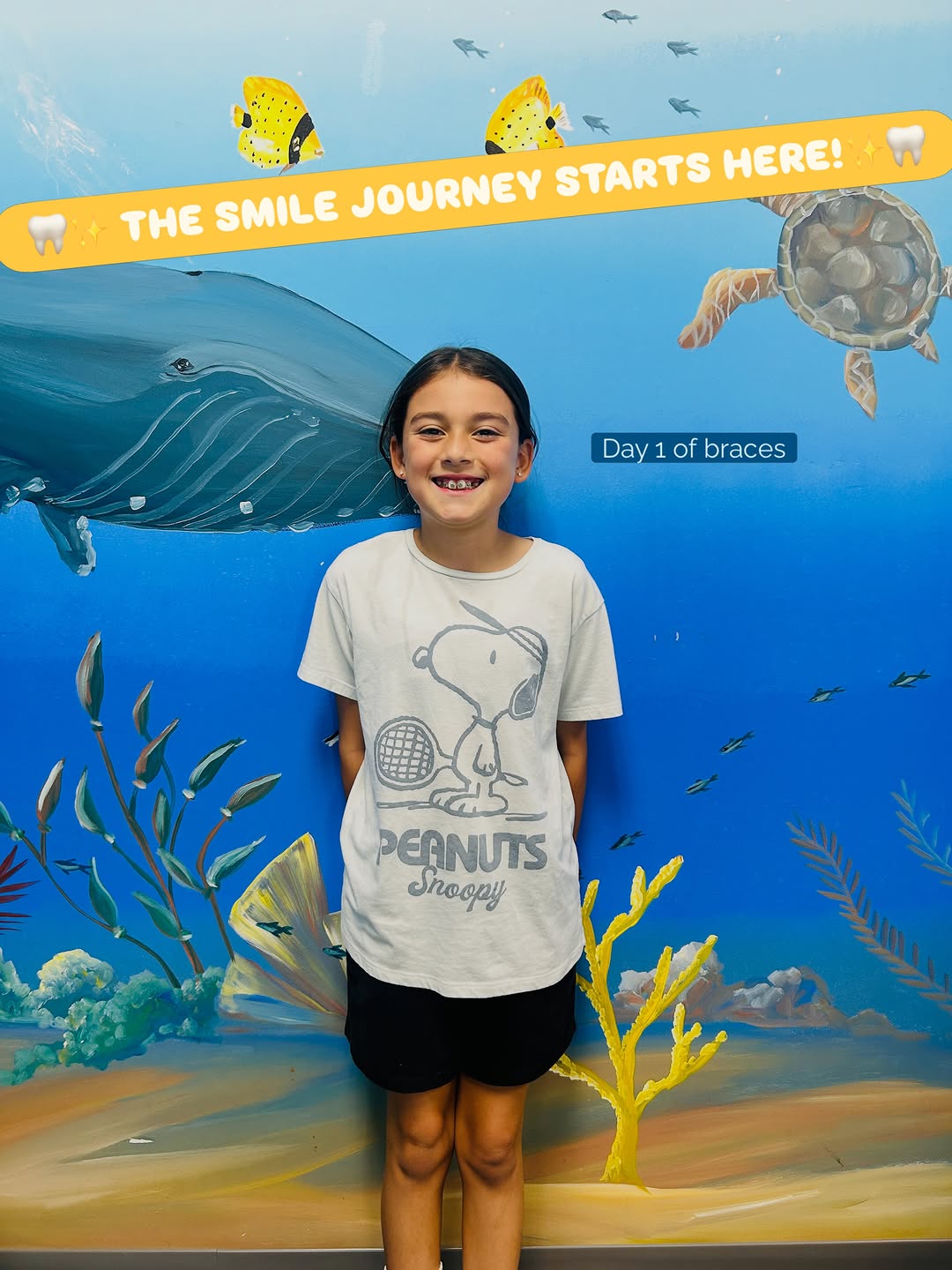 Instagram post by Dr. Shawn L. Miller, D: 🦷✨ Day 1 looks good! ✨🦷 Braces are officially ON, and this smile journey is just getting started! We love getting to be part of these exci…