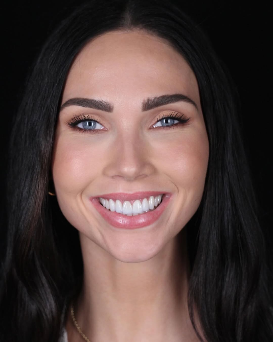 Instagram post by Dr. Shawn Matian, DDS: Portraits of @jessicagreen new smile never get old. Some of our best work. #veneers #dentist