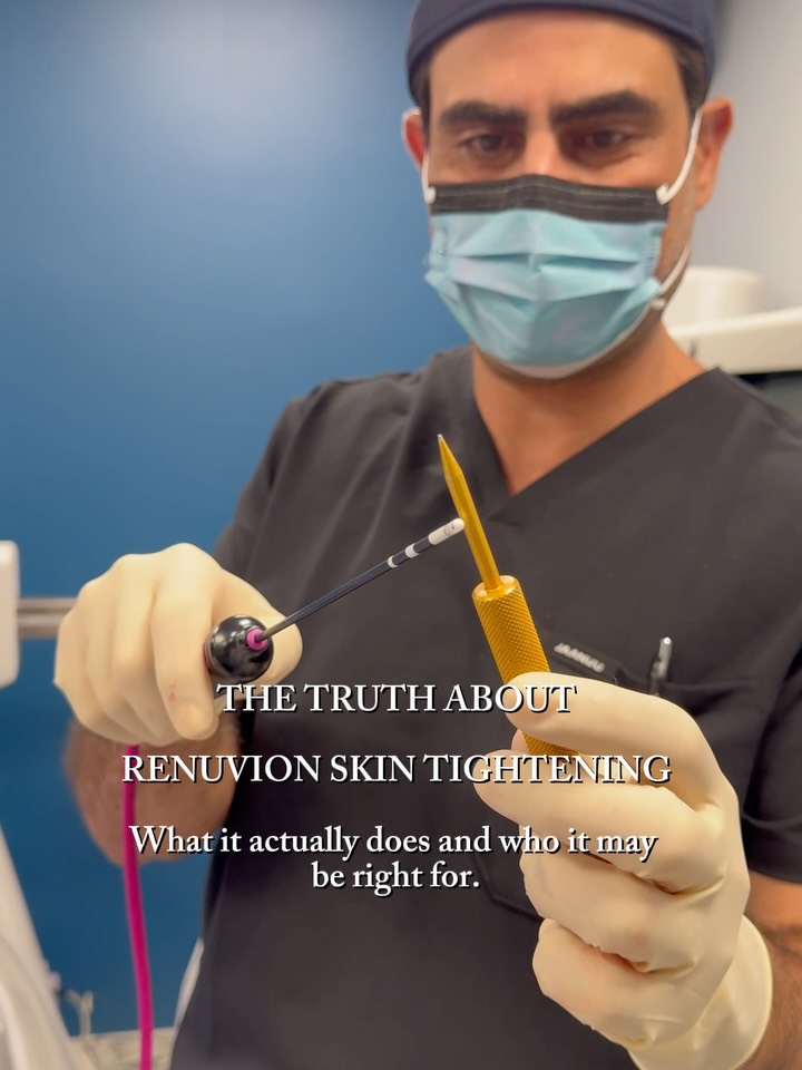 Instagram post by Dr. Shazel Gharbi: Renuvion helps take your results to the next level with skin tightening where you want it most. Ready to tighten up your look? ✨😌 #OldTownM…