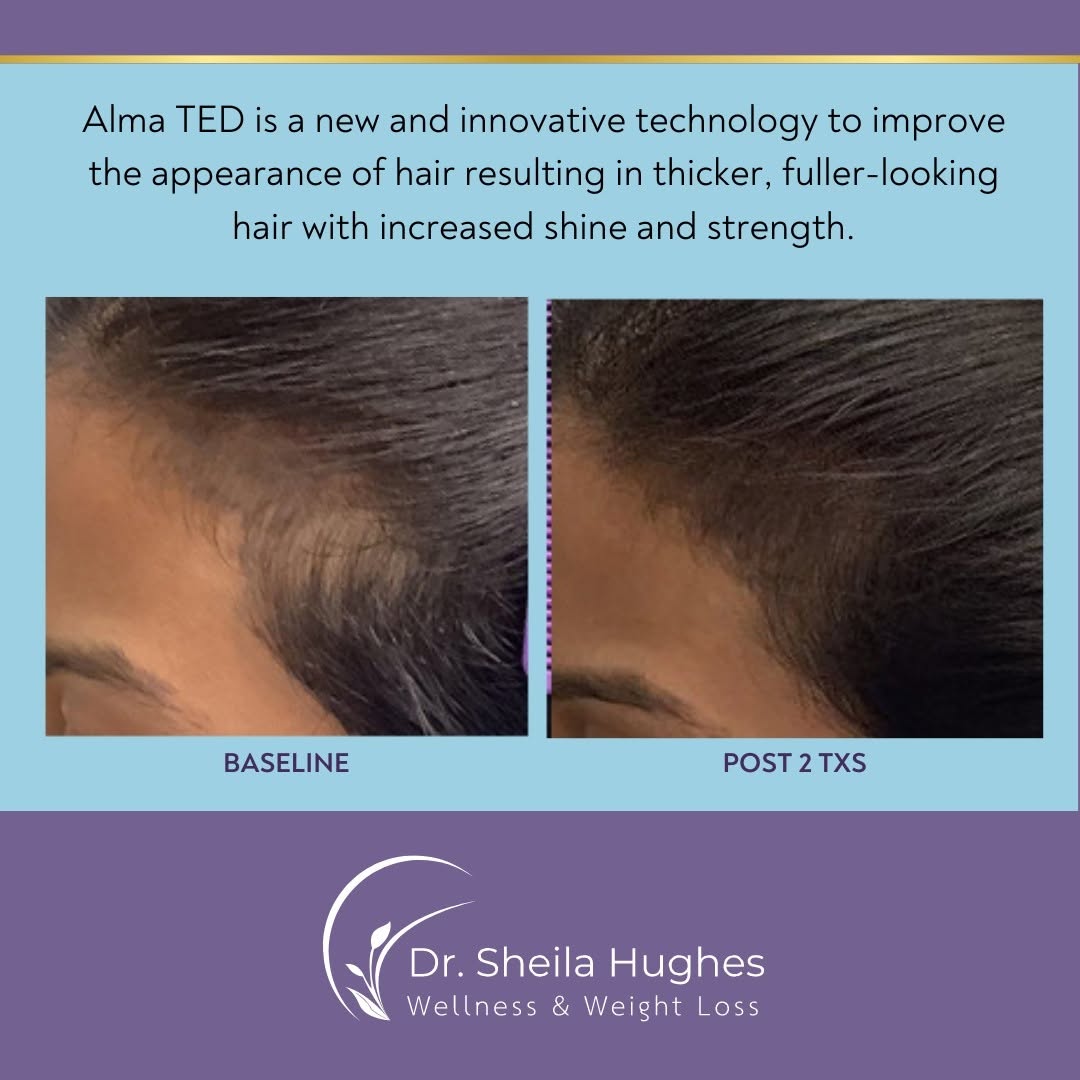 Instagram post by Dr. Sheila Hughes: Hair thinning, shedding or areas of loss? We can also help PREVENT hair loss as well as strengthen and thicken hair strands. Let's get the p…