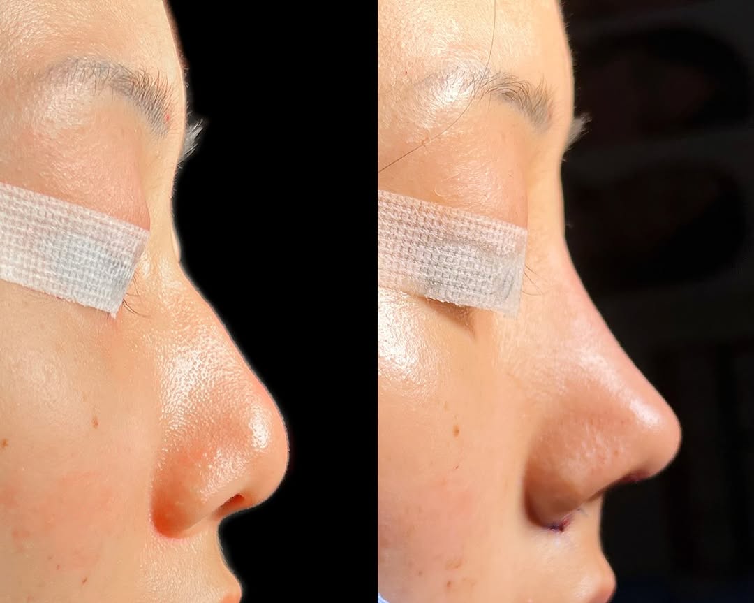 Instagram post by Dr. Shirley Hu: And that’s a wrap on August! A few gems from this past month - Love these individualized results and can’t wait to follow my patients’ journ…
