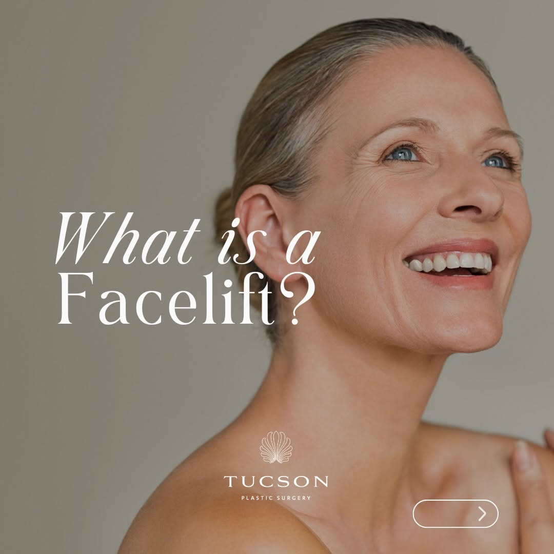 Instagram post by Dr. Silvia Kurtovic: Natural, refreshed, and personalized—modern facelift surgery is all about enhancing you. Want to discuss your options? Call us to book your …