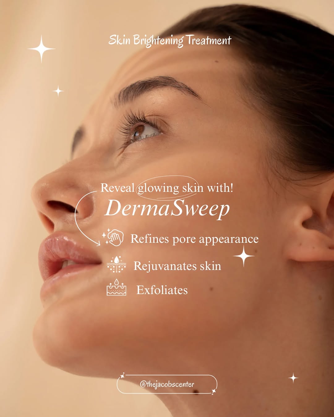 Instagram post by Dr. Stanley W. Jacobs: Sweep away the dullness ✨ DermaSweep = smoother texture + brighter skin + that ✨GLOW✨ Give your skin the refresh it deserves. 🤍 📞Call The …