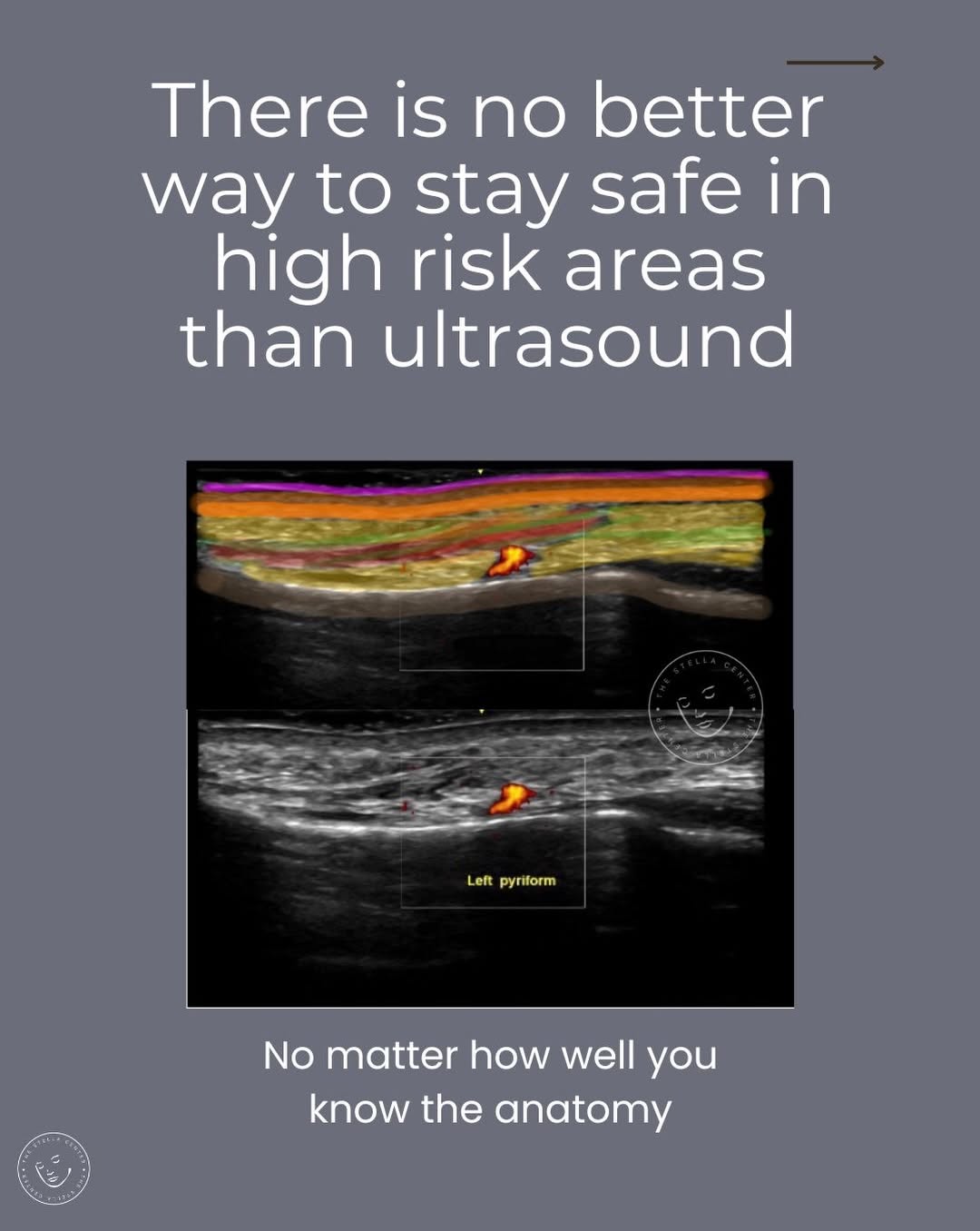 Instagram post by Dr. Stella Desyatnikova: Ready to add ultrasound to your aesthetic practice or improve your skills? My next course is coming up soon in Seattle, July 17-18, and we h…