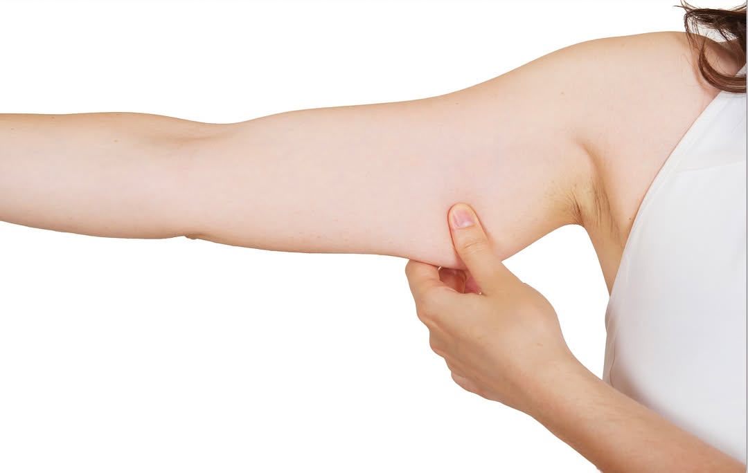 Instagram post by Dr. Stephanie Beidler Teotia: Say goodbye to “bat wings” and hello to sculpted arms! ✨ Curious if an arm lift is right for you? Check out our blog here! https://drstephan…
