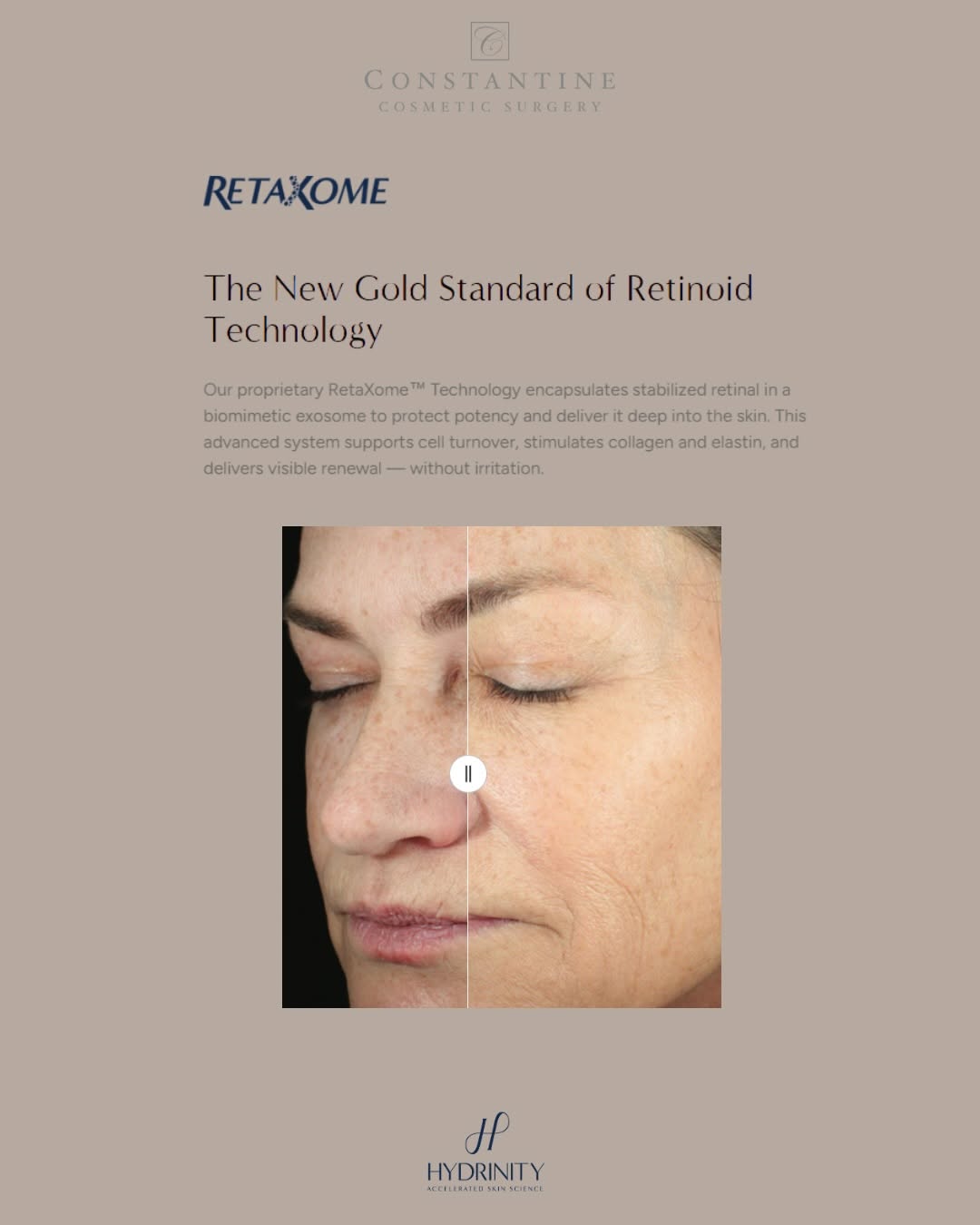 Instagram post by Dr. Steven Constantine, DO: Retinol… but make it smarter. ✨ RetaXome supports skin renewal, improves texture, and promotes a brighter, more even complexion—while respec…