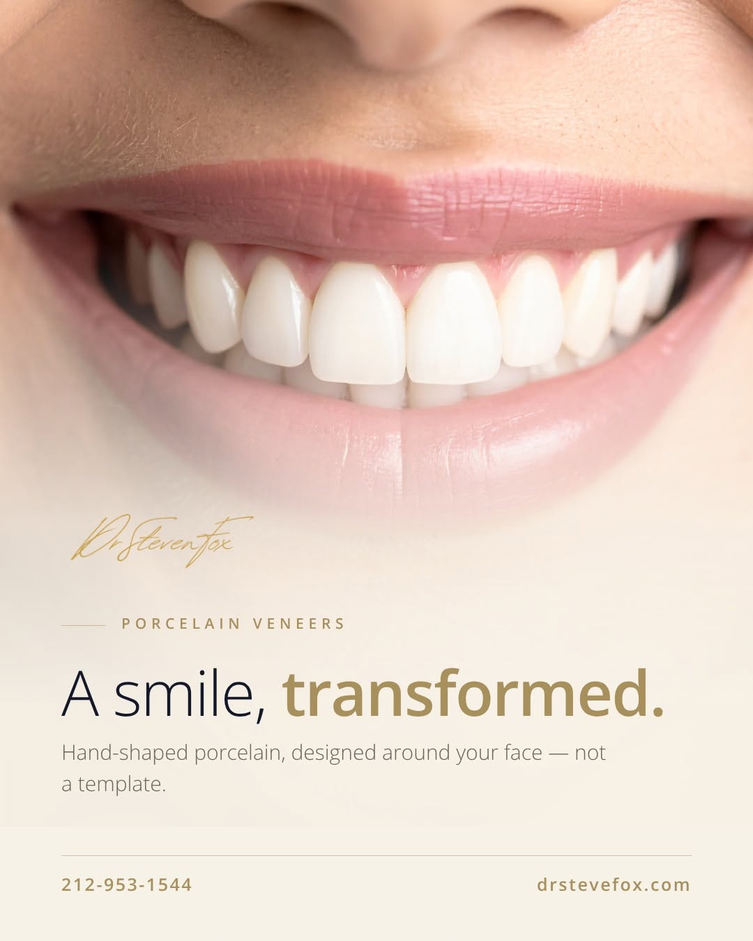 Instagram post by Dr. Steven Fox, DDS: The art of the porcelain veneer. Custom-designed by one of NYC's premier cosmetic dentists, veneers correct shape, color, and alignment for …