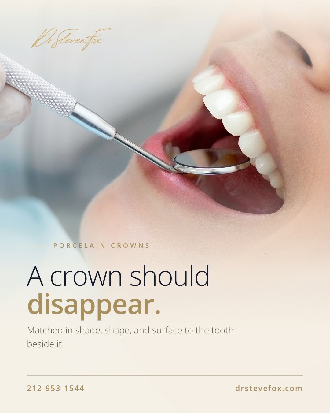 Instagram post by Dr. Steven Fox, DDS: The best crown is the one you can't find. A crown succeeds when it matches its neighbor exactly — in color, contour, and the way it catches …