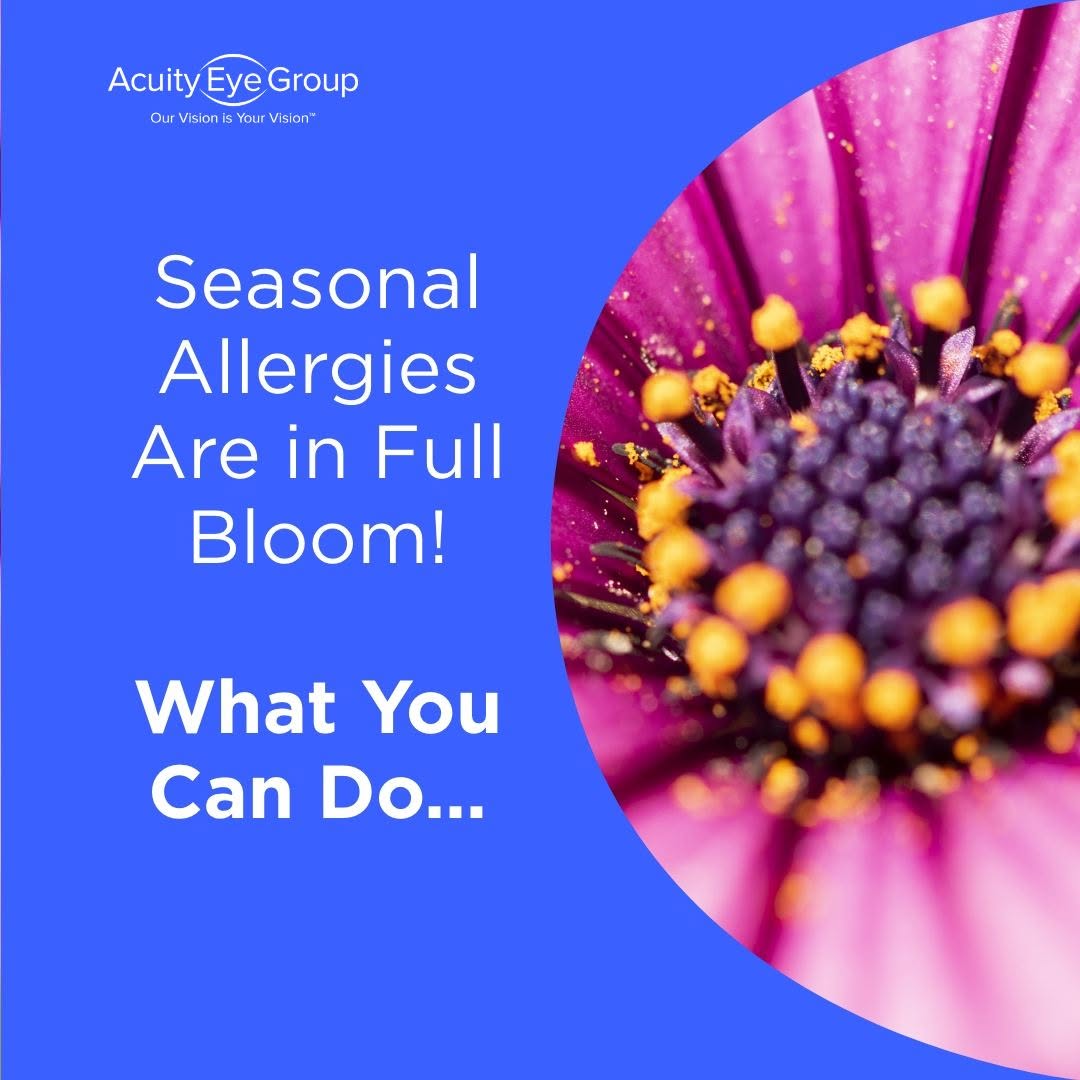 Instagram post by Dr. Steven G. Pratt: Allergy season is here! Do you have itchy, watery eyes from seasonal allergies? You’re not alone. A cold compress, cleaning your contact len…