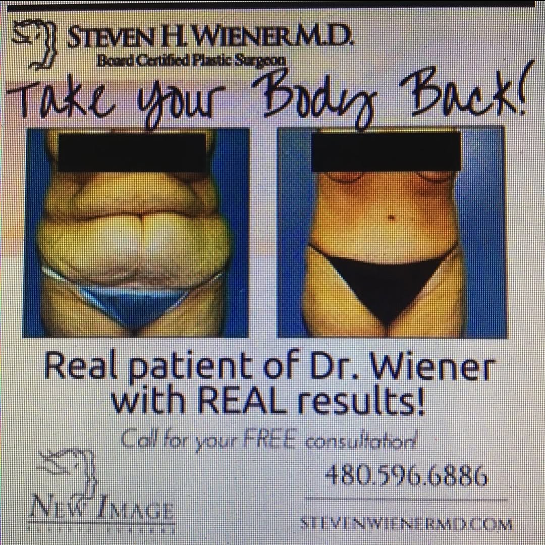 Instagram post by Dr. Steven H. Wiener: Give yourself a early Valentines gift! Set a Complimentary Cosmetic Consultation with Steven Wiener MD 480.596.6886
