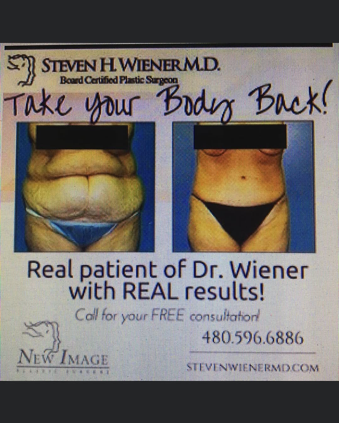Instagram post by Dr. Steven H. Wiener: Call our wonderful staff for a complimentary cosmetic consult with Steven Wiener MD, Board Certified Plastic Surgeon 480.596.6886 Www.Steven…