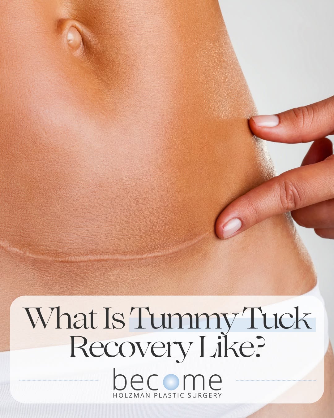 Instagram post by Dr. Steven Holzman: Recovering from a tummy tuck is a process, and understanding the timeline can help patients feel more prepared and confident going into surg…