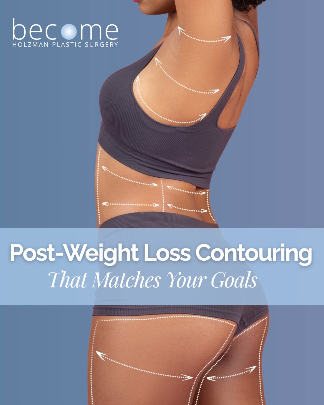 Instagram post by Dr. Steven Holzman: Loose skin after major weight loss can affect more than appearance. Many patients experience: • Skin irritation • Difficulty with exercise •…