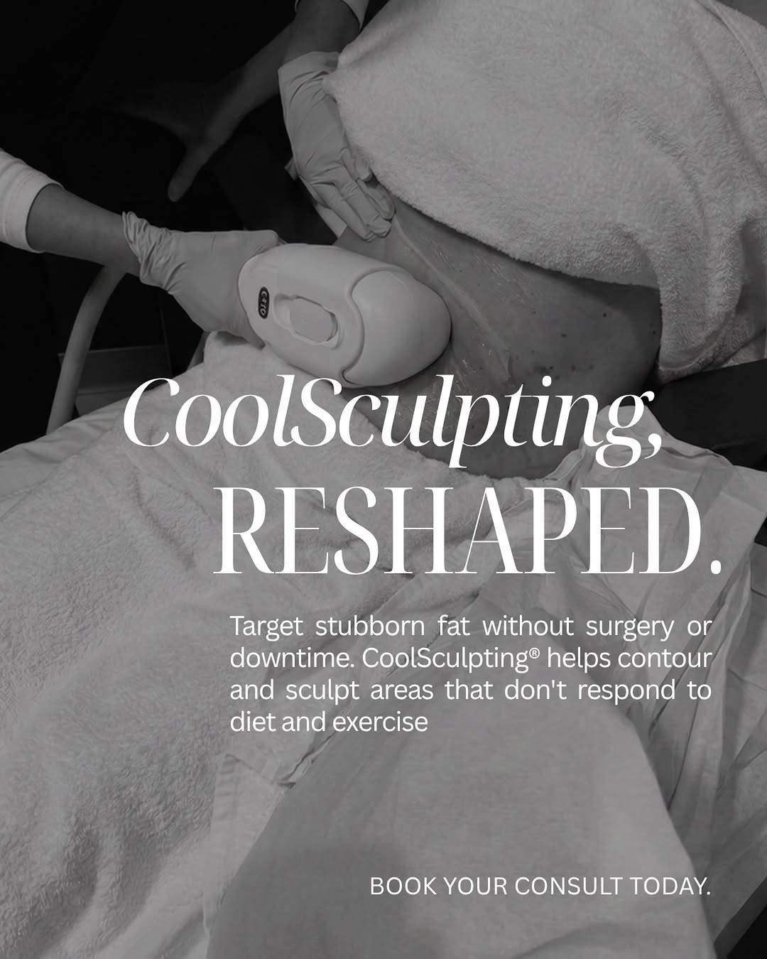 Instagram post by Dr. Steven L. Robinson: Sculpt. Contour. Confidence. ✨ Your healthiest lifestyle deserves results that go the extra mile. CoolSculpting® targets stubborn fat to hel…