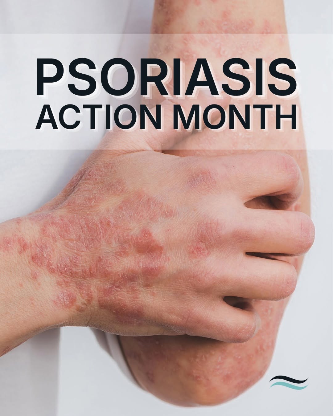 Instagram post by Dr. Stewart Little: Clearer, more comfortable skin may be possible, and you deserve care that considers the full impact psoriasis has on your life. 💙
