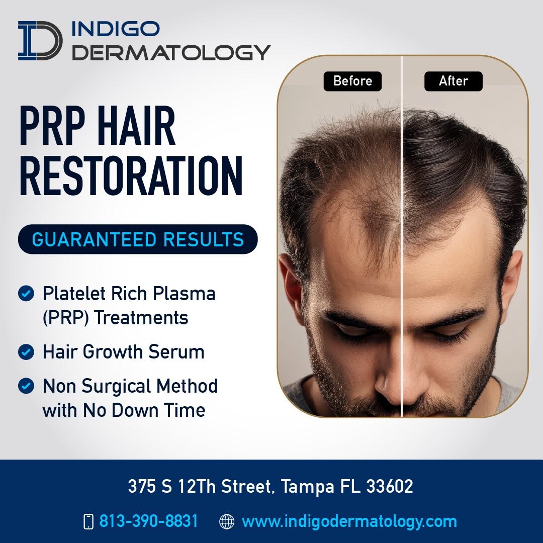 Instagram post by Dr. Sumeet Thareja: Increase hair density with PRP Hair Restoration Therapy. Our hair growth experts can deliver results within a matter of weeks. Call 813-390-…
