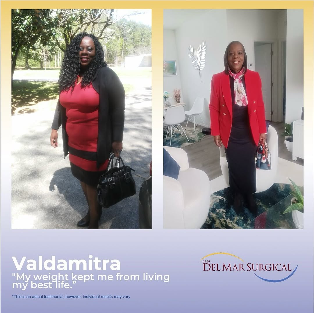 Instagram post by Dr. Sunil Bhoyrul: ✨A Journey to a New Life! ✨ Before her weight loss surgery, Denise’s life felt like a constant struggle. She was held back by her weight, ba…