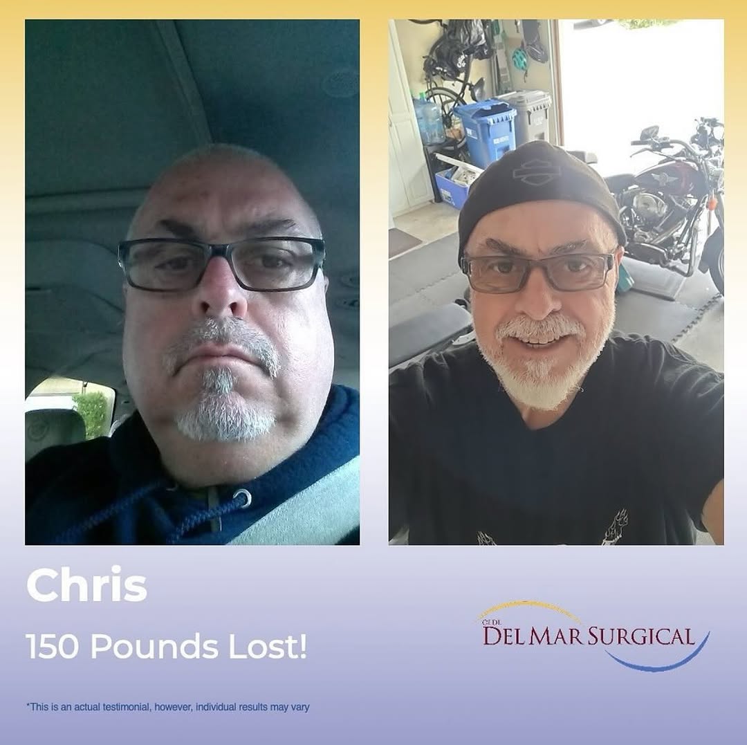 Instagram post by Dr. Sunil Bhoyrul: Meet our amazing patient, Chris! 🌟 “I’ve always been big—375 pounds at my lowest point, feeling lost after a motorcycle accident. I struggl…