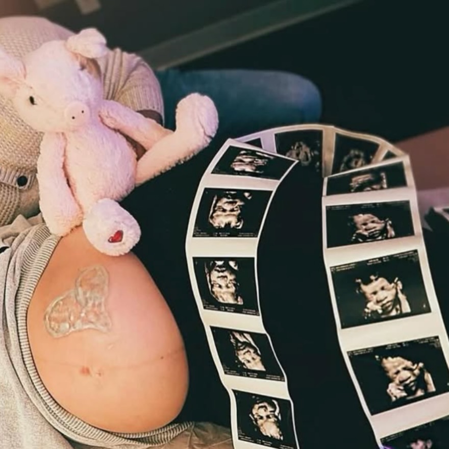 Instagram post by Dr. Suzanna Chatterjee: The @mybabysheartbeatbear make the sweetest baby announcements! 🧸💚 We are already dreaming up the sweetest fall announcements, full of aut…