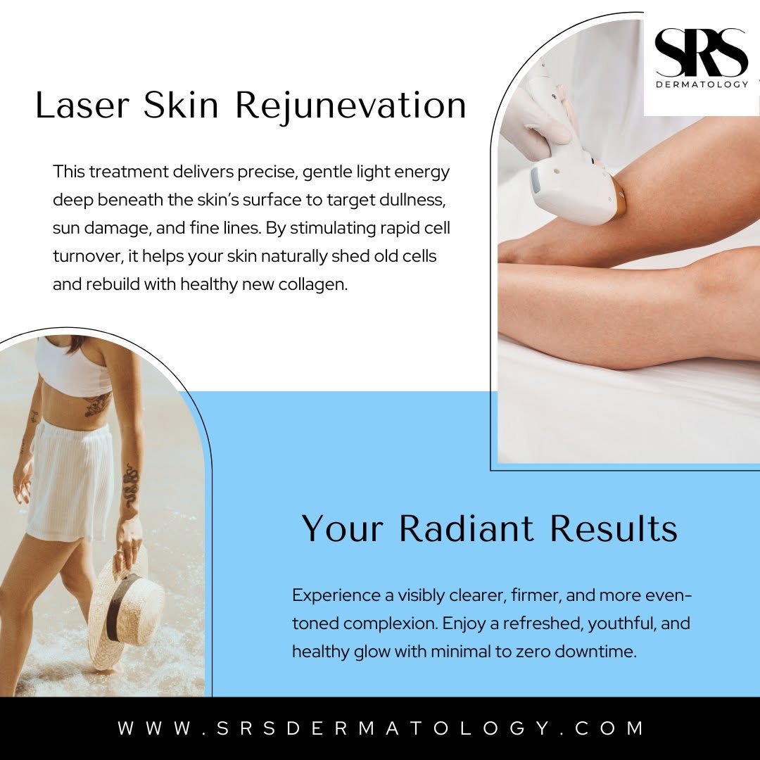 Instagram post by Dr. Suzanne Sirota Rozenberg, DO, FAOCD, FAAD: Say goodbye to persistent dullness and hello to your skin’s natural radiance. Our gentle Laser Skin Rejuvenation works beneath the surface t…